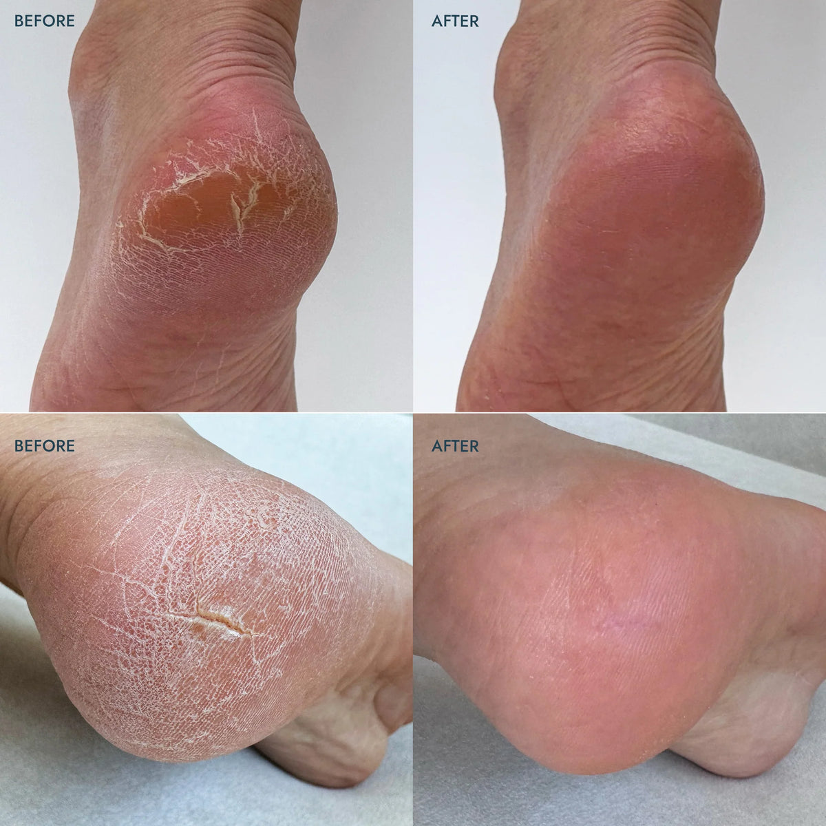 Heel Repair Balm - Lavender